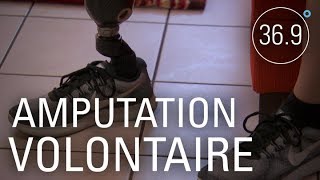 Chronique d'une amputation