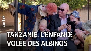 Documentaire Tanzanie : l’enfance volée des albinos