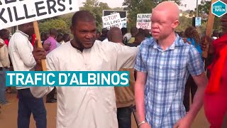 Documentaire Trafic d’Albinos