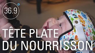 Tête plate du nourrisson : c'est grave docteur ?