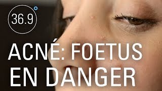 Documentaire Prescriptions contre l’acné : le scandale continue!