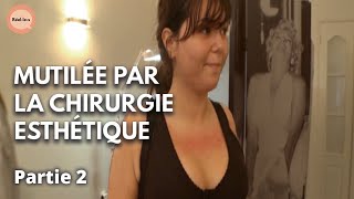 J'ai été victime de la chirurgie esthétique à 24 ans I Partie 2