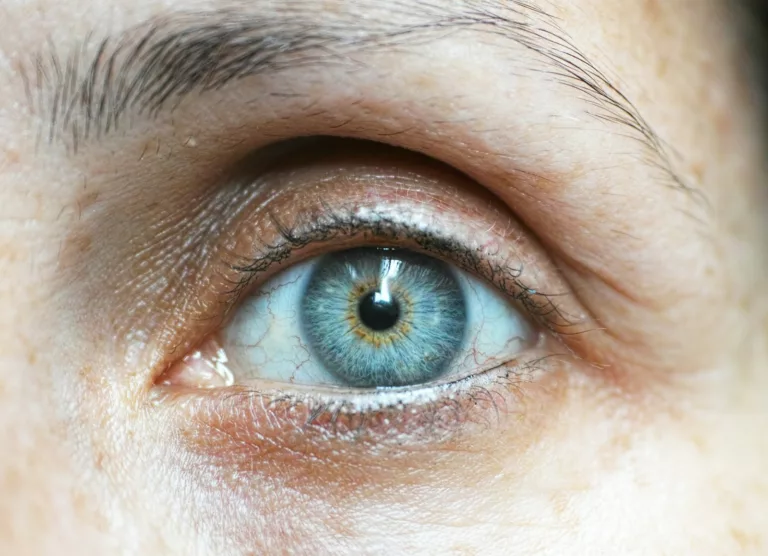 Article | Poches sous les yeux : comment s’en débarrasser ?