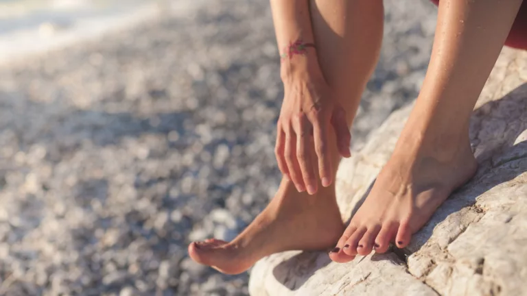 Article | L’algodystrophie des pieds : symptômes, causes, diagnostic et traitements