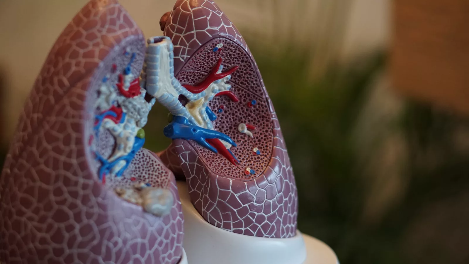 Scintigraphie du poumon : à quoi ça sert ?