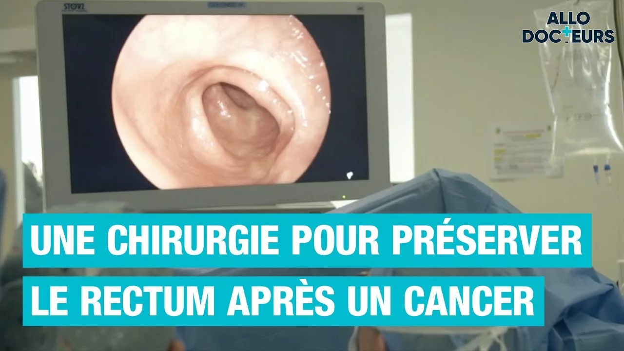 Documentaire Cancer du rectum : tout savoir sur la chirurgie de préservation