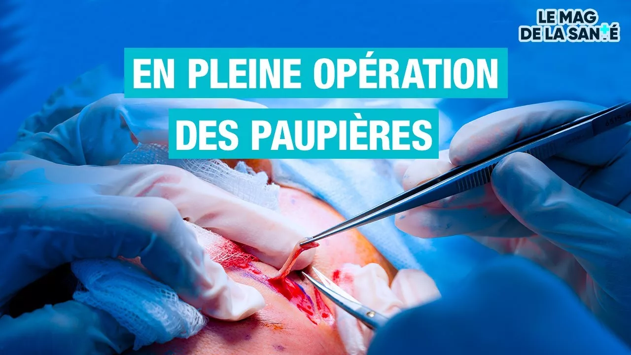 Une chirurgie pour remonter les paupières