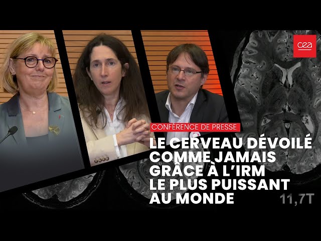 Le cerveau dévoilé comme jamais grâce à l’IRM le plus puissant au monde